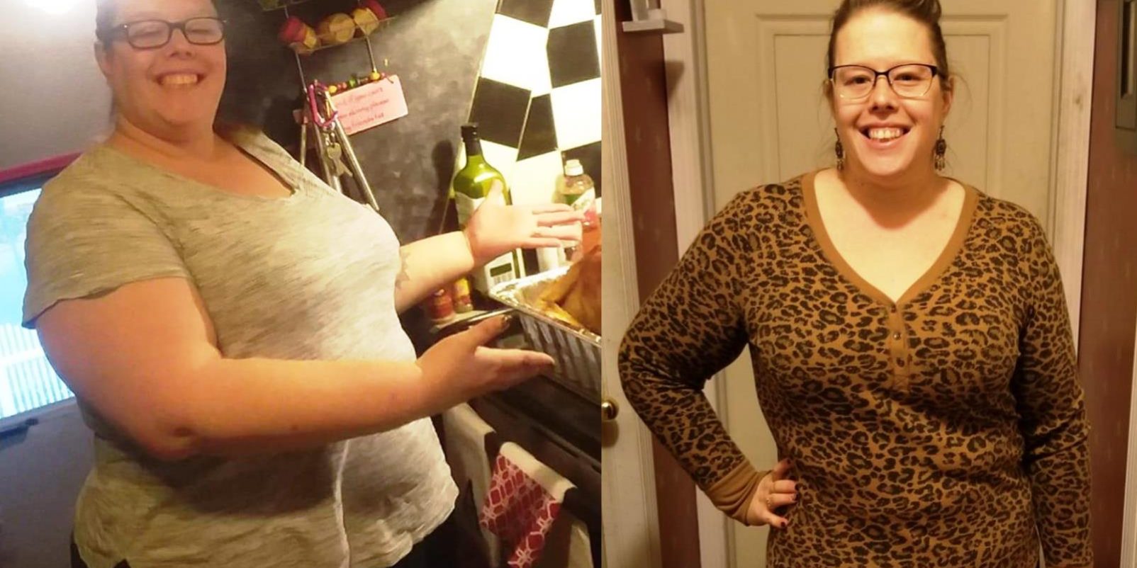 Before and after bariatric surgery, gastric sleeve