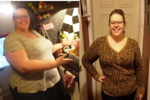 Before and after bariatric surgery, gastric sleeve