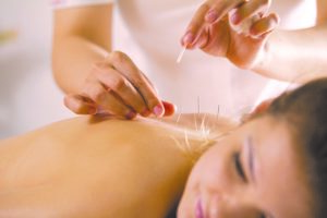 Acupuncture treatment